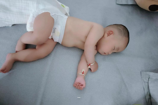 石河子宝宝脸上有白色斑块